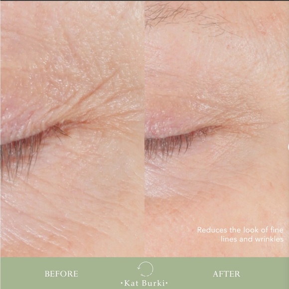 KAT BURKI | Lift & Fill | Form Control Marine Collagen Gel - Picture 7 of 12